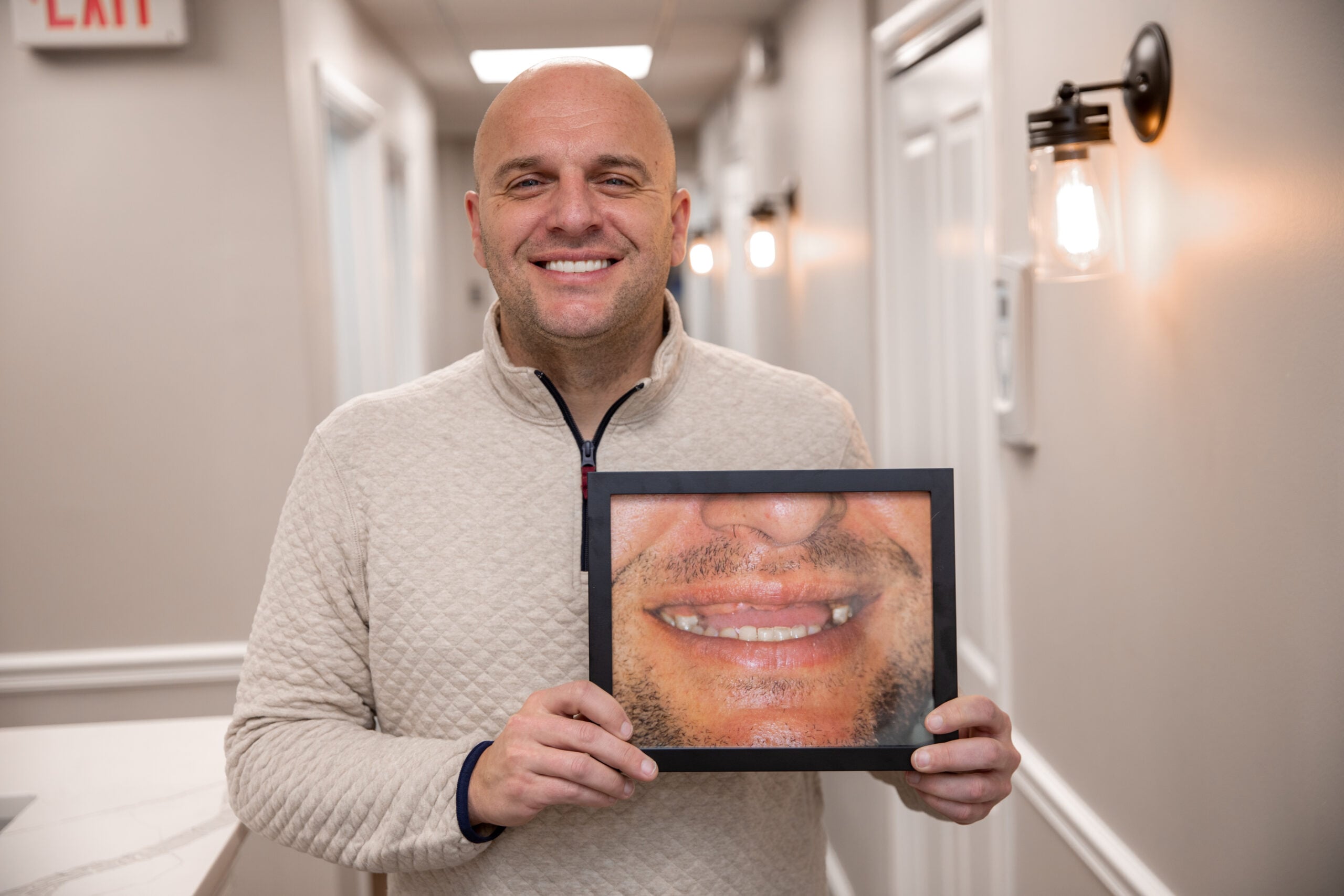 Dr. Marino's patient holding up their before photo and smiling